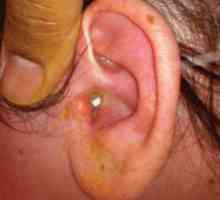 Zánět středního ucha ucho: léčba, příznaky a příčiny