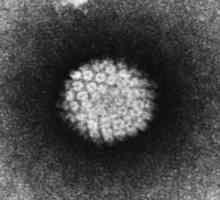 Papilomavirus infekce Human: základy