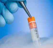 Převod kryokonzervovanými embryí. V vitro fertilizace