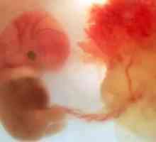 Placenta - je hlavním orgánem pro maminku a dítě!