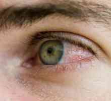 Proč červené oči, a jak odstranit nepříjemné pocity?