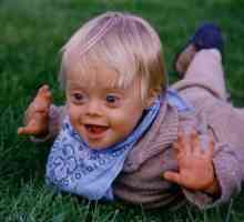 Proč se dítě narodí s Downovým syndromem - otázku, která není zodpovězena