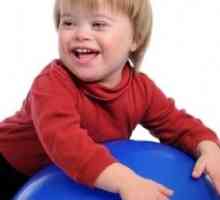 Proč děti se narodí s Downovým syndromem? Přesnou odpověď na tuto otázku není