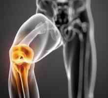 Následky poranění kolena. Protetiky a rehabilitační