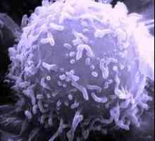 Zvýšené lymfocyty: Kdo je na vině, a co dělat?