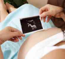 Zvýšená děložní tón: Příčiny