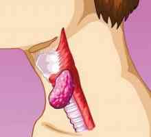 Příčiny a příznaky zánětu mízních uzlin na krku