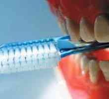 Prevence zubního kazu: zuby, které jsou zdravé