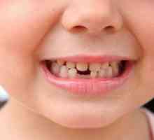 Erupce a růst zubů u dětí: tabulky. All erupce primárních zubů u kojenců