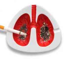 Rakovina plic: první příznaky. Jak nevynechat?