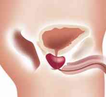Rakovina prostaty: střední délka života v různých stadiích onemocnění