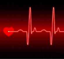 Rozluštění EKG srdce