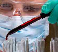 Sérologické krevní testy v diagnostice chorob