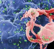 Symptom AIDS: Jak se nemoc projevuje?