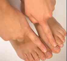 Příznaky plísně nehtů na nohou, a charakteristiky odrůdy