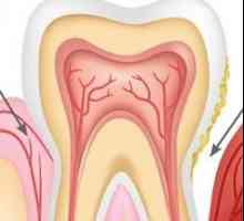 Příznaky periodontální onemocnění, diagnostika a léčba