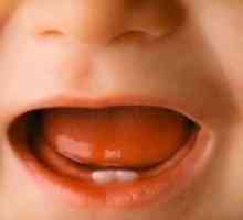 Symptomy řezných zubů u dětí: zda rodiče zkušenosti?