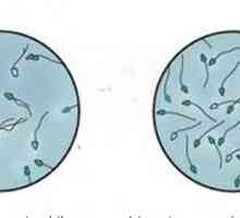 Sperma "in-vitro" - přesnost záruka