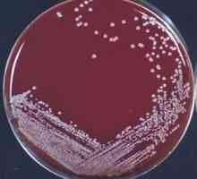 Staphylococcus epidermidis (Staphylococcus epidermidis) - příznaky, příčiny, léčba. Podle toho, co…