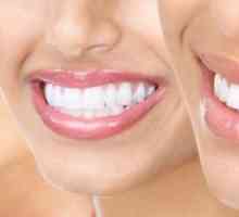 Zubní profylaxe pro prevenci onemocnění zubů a dásní