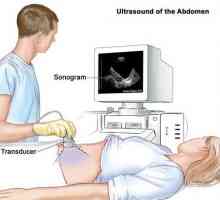 Transabdominální ultrazvuk - co je to? Transabdominální pánevní ultrazvuk