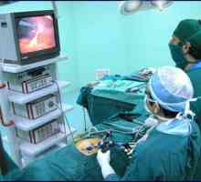 Hysterektomii laparoskopická metoda: pooperační období, důsledky recenze. Odstranění děložní myomy…