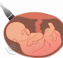 Ultrazvukový screening studie. Screeningový test v průběhu těhotenství