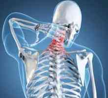 Unkovertebralny osteoartritida krční páteře: příčiny a léčba
