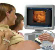 3D ultrazvuk v průběhu těhotenství