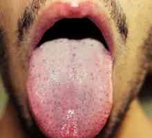 Zjistěte si, co je příčinou bílé skvrny na jazyku u dospělých