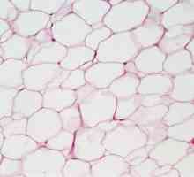 Виды эпителиальной ткани. Эпителиальные ткани: строение и функции