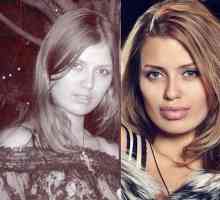 Виктория Боня до и после пластики губ