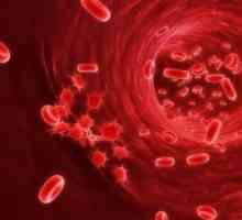 Vnitřní krvácení: Příznaky a typy