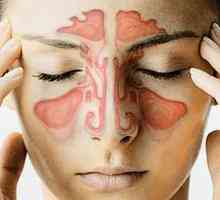 Zánět vedlejších nosních dutin, nebo Co je zánět vedlejších nosních dutin
