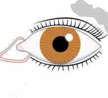 Zánět slzné žlázy: příčiny, léčba simtomy