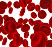 Krevní poruchy: seznam nejnebezpečnějších