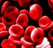 Proč potřebuji znát identifikaci krevní skupinu?