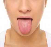 Žlutá jazyk nátěrové: příčiny a léčba