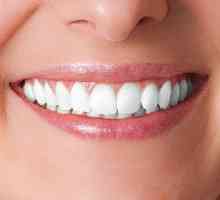 Zubní implantáty: klady a zápory. Zubní implantáty: cena, recenze