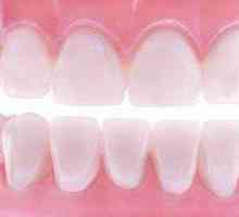 Měkké zubní protézy: Poloha specialisté fotky