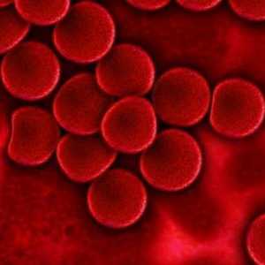 Aglutinaci krve - je ... Krevní skupiny a aglutinace