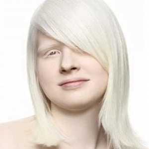 Albíni - A ... albinismus - vrozené absence melaninu pigmentu