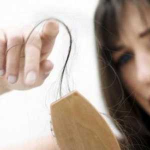 Alopecie u žen - Co je to? Léčba alopecie u žen