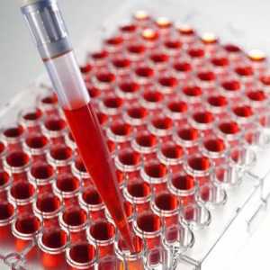 Krevní test na TBC: funkce, typy a dešifrování