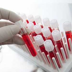 Krevní test na rakovinu. Je možné určit krevní test na rakovinu?