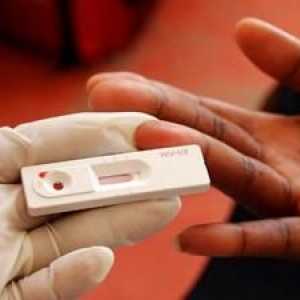 Zkušební HIV: Podmínky připravenosti, kde a kdy se