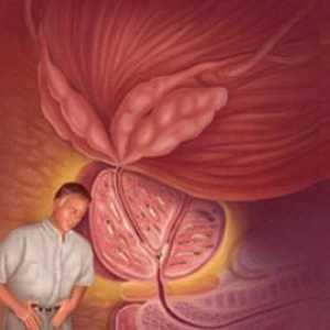 Onemocnění prostaty: Léčba Drug