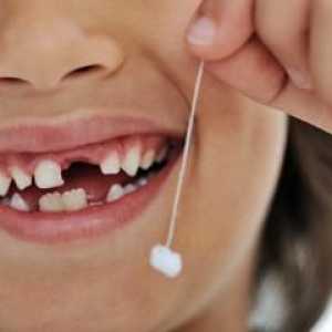 Co dělat, když dítě zuby vypadnou