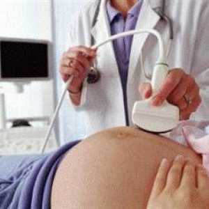 Co je míněno pánevní ultrazvuk?