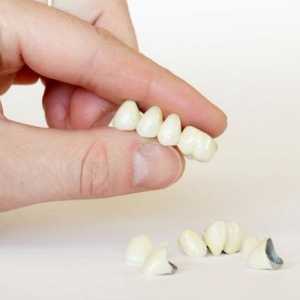 Co je to zubní protetiky? typy protetiky